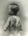 Click image for larger version. 

Name:	1900 BOY CRUELLY NEGLECTED BY PARENTS FILE 15534 MGA014428.jpg 
Views:	1206 
Size:	108.4 KB 
ID:	933